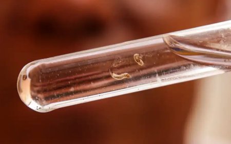 Brasil passa de 4 milhões de casos de dengue; mortes chegam a 1.937, Veja Sintomas