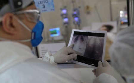 Broncopneumonia: doença que levou Bolsonaro à UTI