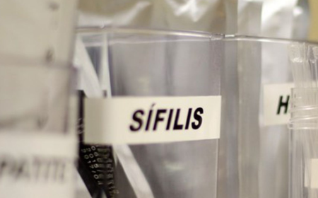 SP oferece testes grátis de HIV e ISTs neste domingo