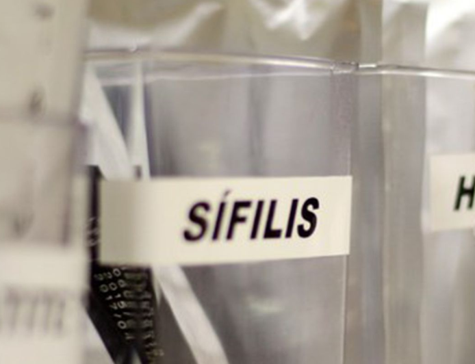 SP oferece testes grátis de HIV e ISTs neste domingo