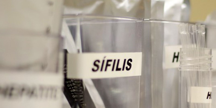 SP oferece testes grátis de HIV e ISTs neste domingo