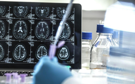 Medicamento para Alzheimer chega ao Brasil em junho